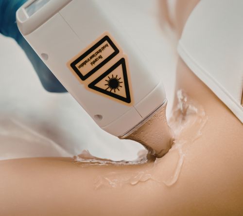  laser & rf procedures