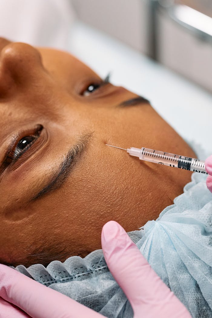 gallery-3 Close-up image of a cosmetic procedure showing a needle injecting into a forehead.